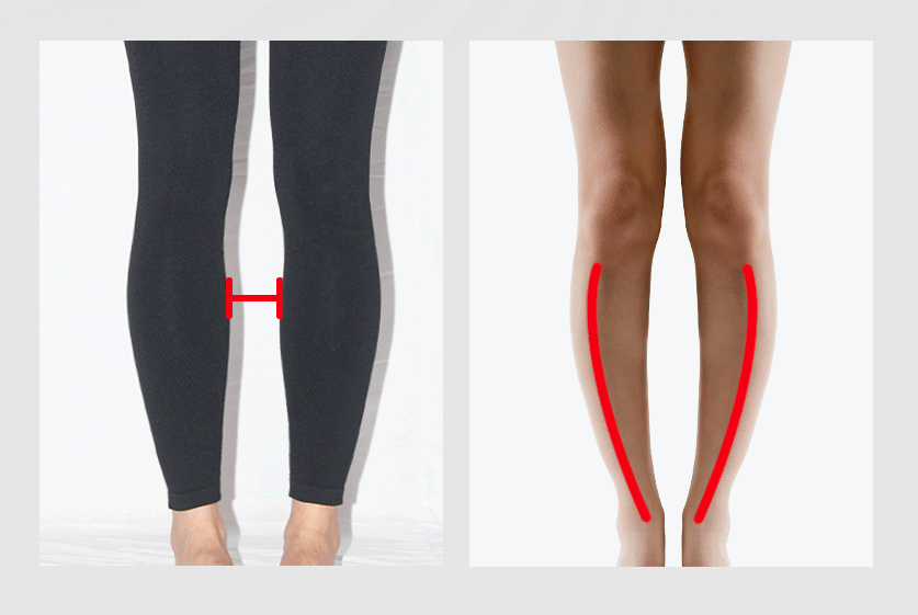ARCHFINE - Arch Support Insoles for Men&Woman