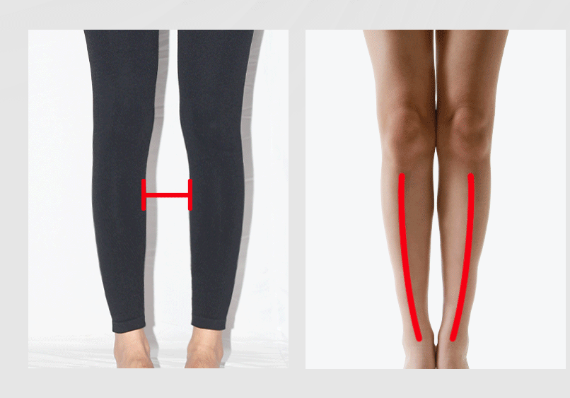 Premium Arch Support Insoles for Men & Women - Professional Orthotic Posture Support